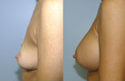 Augmentation Only