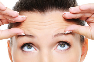 Transverse Forehead Lines