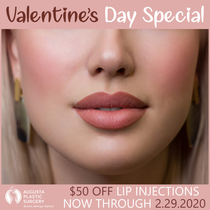 $50 OFF Lip Filler